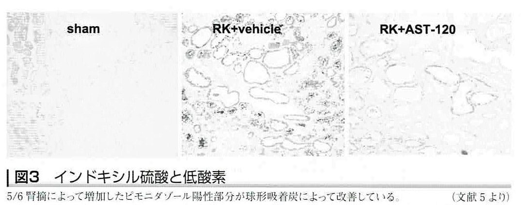 クレメジン®（慢性腎臓病の薬）2