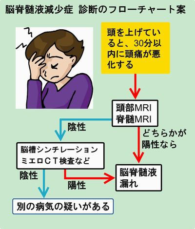 脳脊髄液減少症」に新しい診断基準 - 人と車の安全な移動を