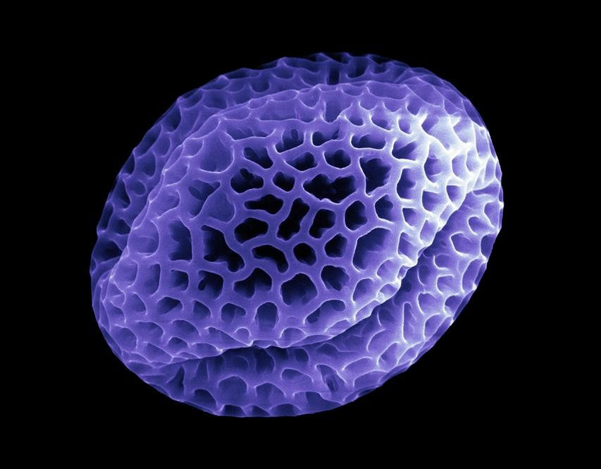 Pollen L - Winzige Schnheiten - Bilder aus dem Rasterelektronenmikroskop