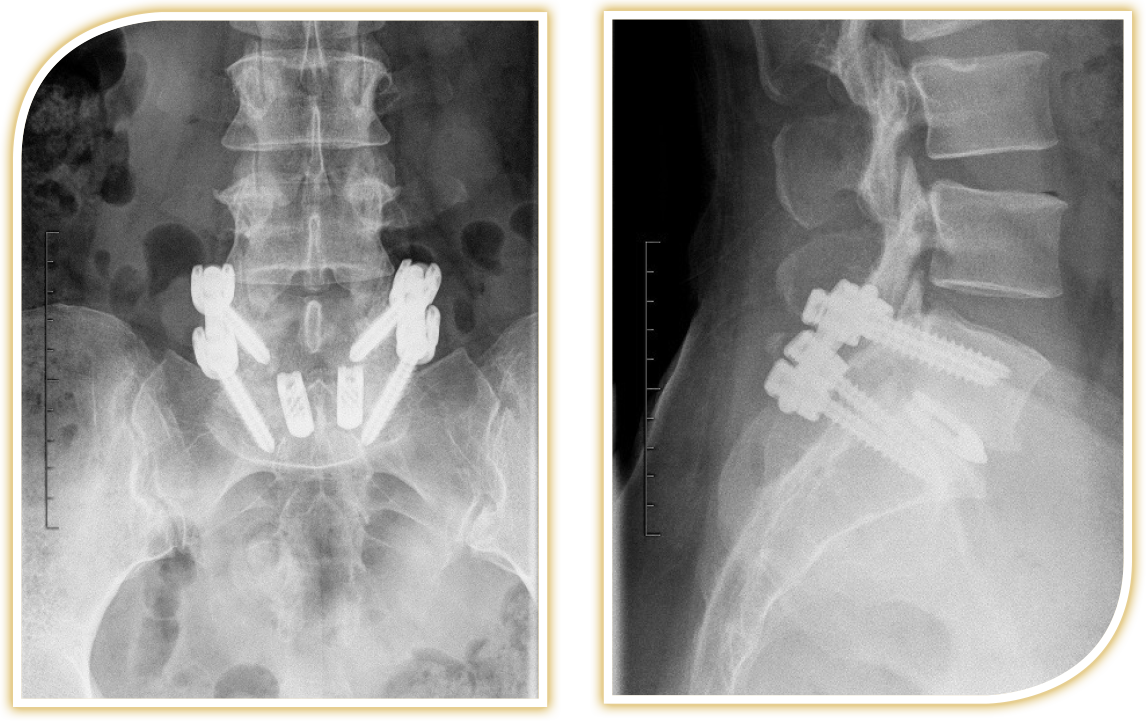 Therapieformen (Filme) Neurochirurgie in Wiesbaden