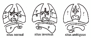 PT: poumon trilobé, PB: poumon bilobé, F: Foie, E: Estomac, D: Auricule Droit, G: Auricule Gauche, ?: Indeterminé