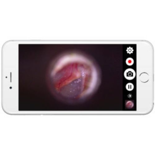 What You Might NOT Know About Firefly Video Otoscopes! The Hearing