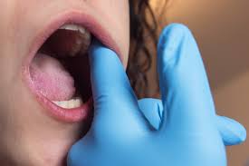 Terapia temporo-mandibolare