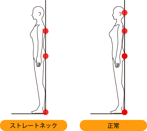 簡単なストレートネックの調べ方