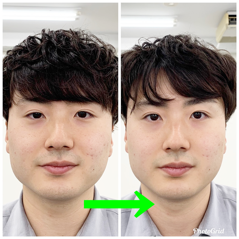 小顔のビフォー アフターで変化がでない原因 治療院 美容院 エステ リラクゼーションサロンに導入できる 小顔 ボディストレッチ 小顔のビフォー アフターで変化がでない原因 治療院 美容院 エステ リラクゼーションサロンに導入できる 小顔 ボディストレッチ