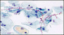 CANDIDA