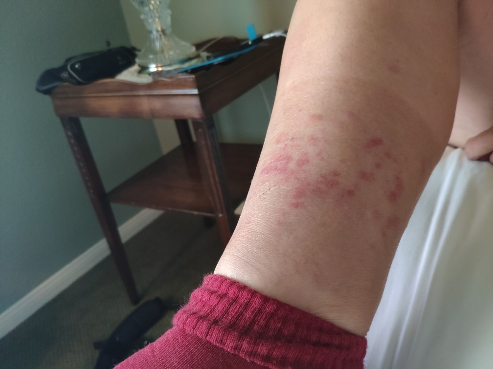 26) Golfer's Rash pct2019s seite!