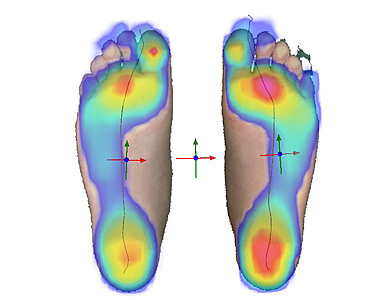 Überlagerte Darstellung 2D-Messung und dynamische Fußdruckmessung