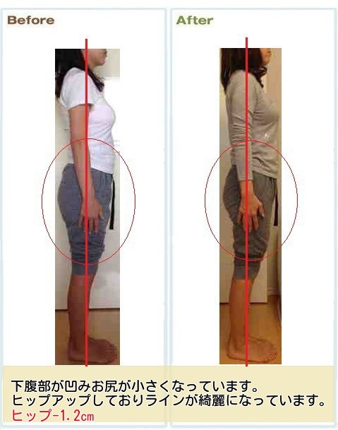 ※お客様個人の感想です。矯正後の感じ方は個人差がございます。