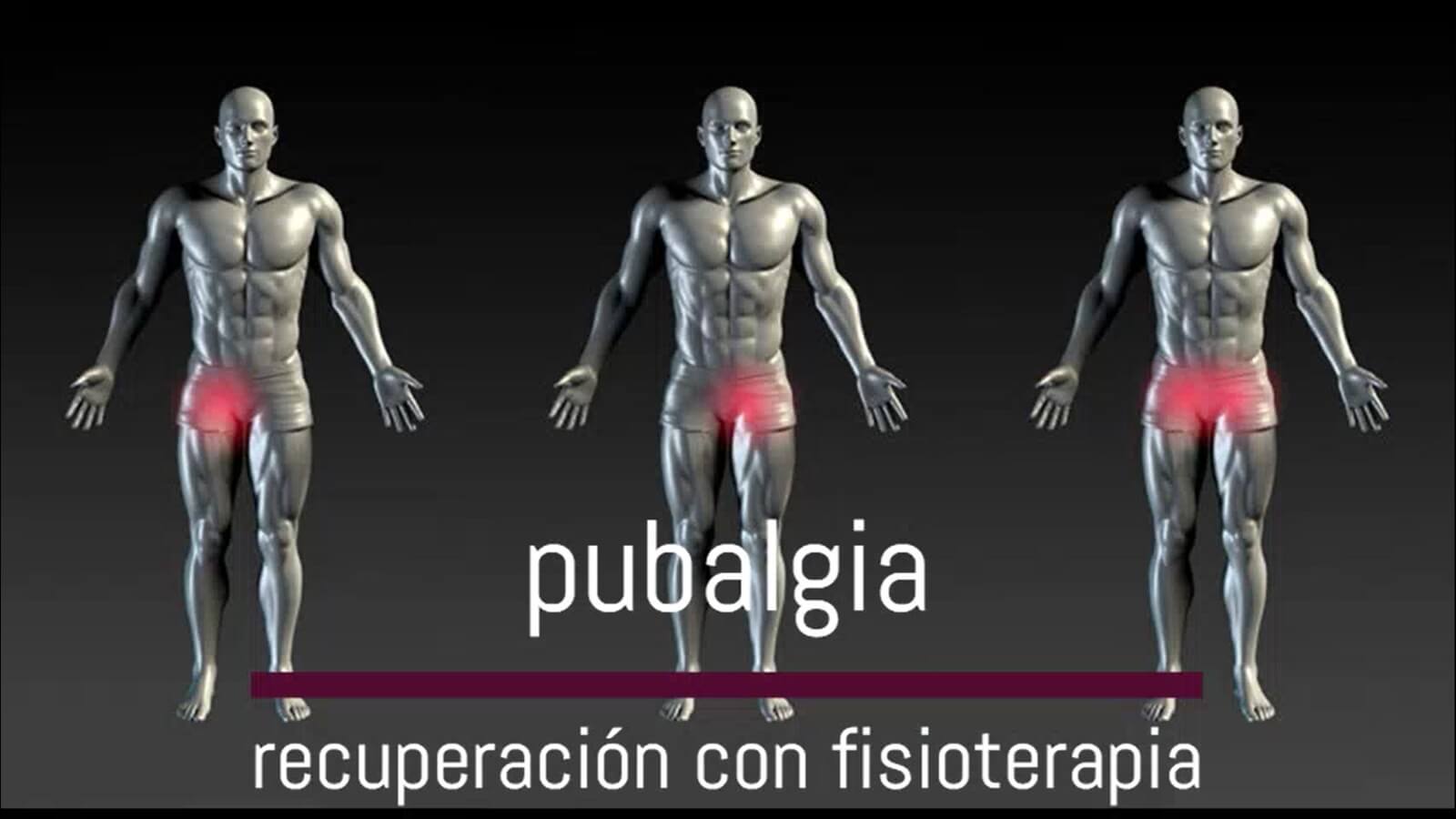 RECUPERACIÓN Y TRATAMIENTO DE PUBALGIA EN CARABANCHEL (MADRID
