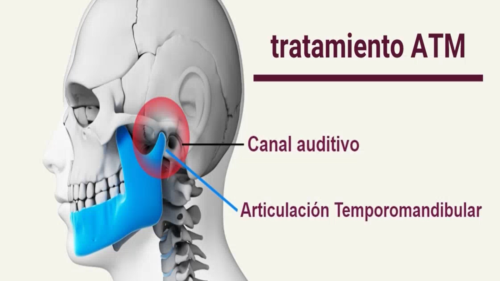 tratamiento bruxismo y atm en