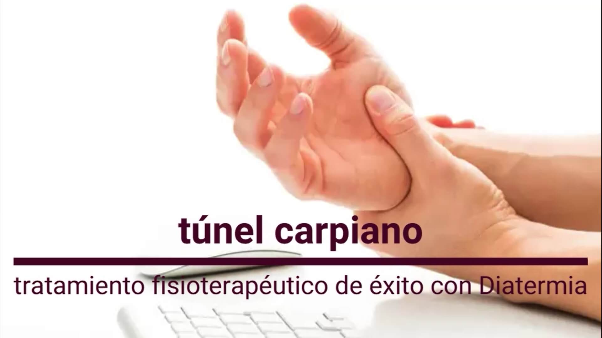 TRATAMIENTO TÚNEL CARPIANO - ✔️ San Javier Fisioterapia