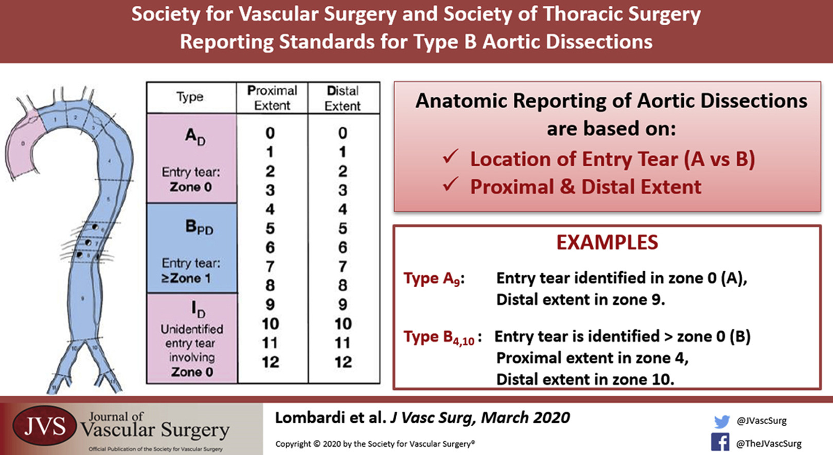 VSITE Review Aortic Dissections Audible Bleeding The Vascular vsite-review-aortic-dissections-audible-bleeding-the-vascular