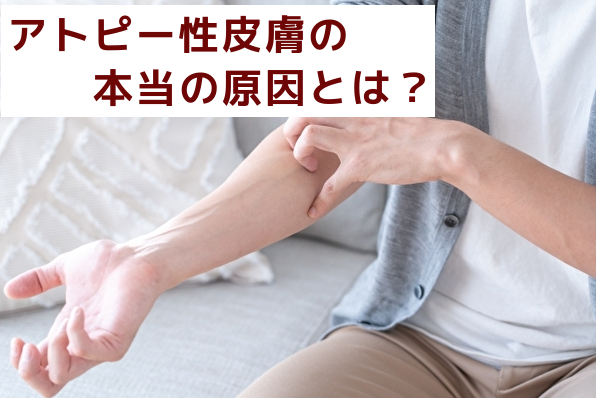 アトピー性皮膚炎の本当の原因とは（名古屋市天白区の鍼灸院‐大根治療院）