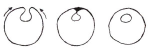 3. zīmējums: Turpinājums A: Rievas malu saslēgšanās. B: Slēgta.  C: Ārējā slāņa (ādas) atdalīšana no cauruļveida struktūras (muguras smadzenēm).