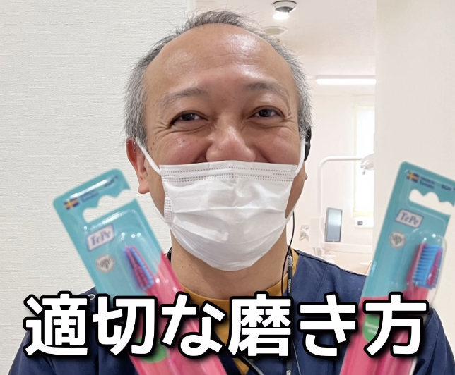 根面う蝕を意識しよう！