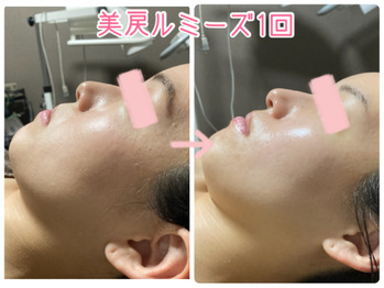 岐阜県多治見市の肌改善専門オーダーメイドエステサロンリトハピです。ニキビ・毛穴・たるみ・しわ・シミ・敏感肌・赤み改善はお任せください！化粧品代理店様募集中です