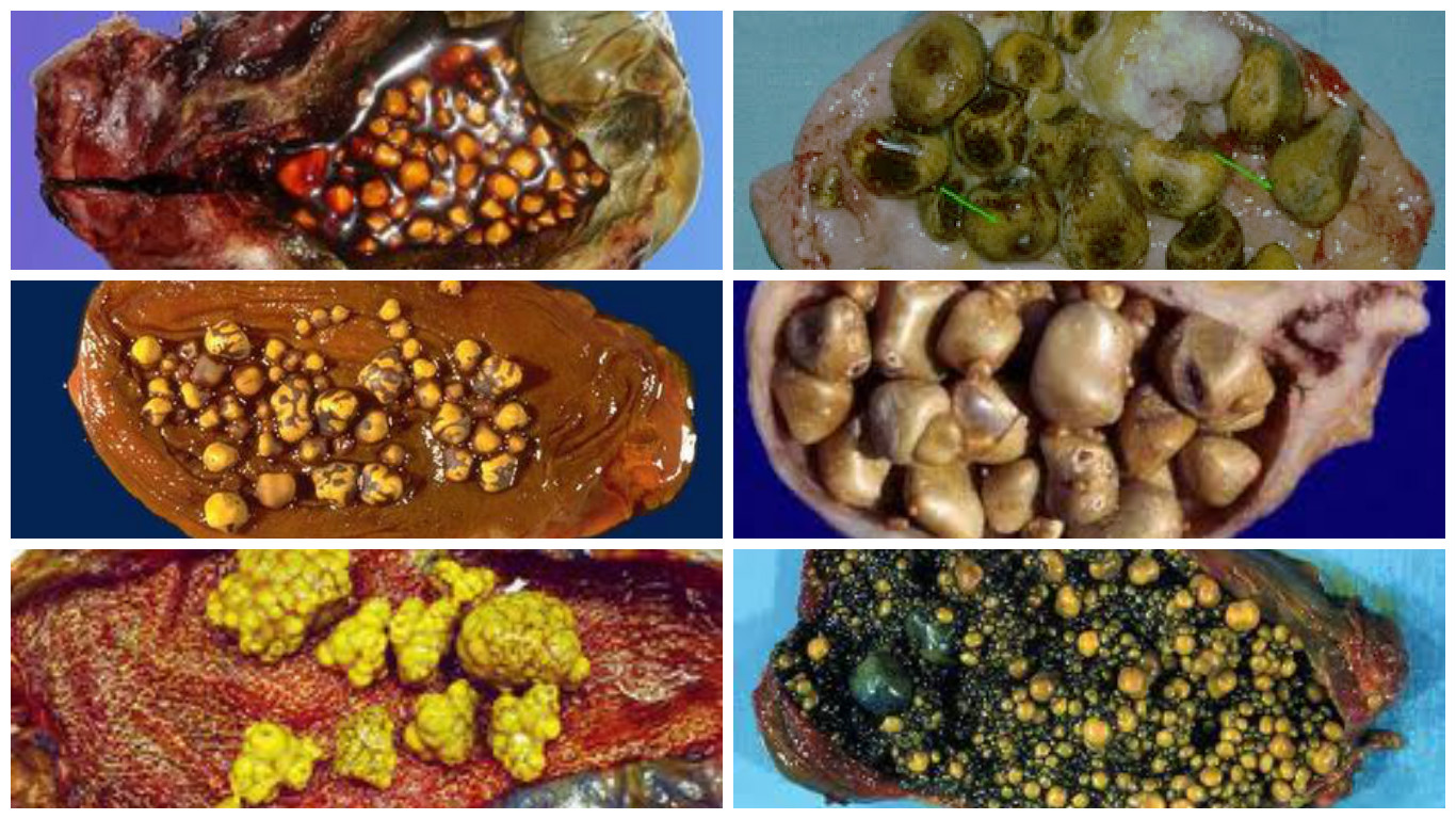 Colon Saludable Pagina Web De Juandedios Salud