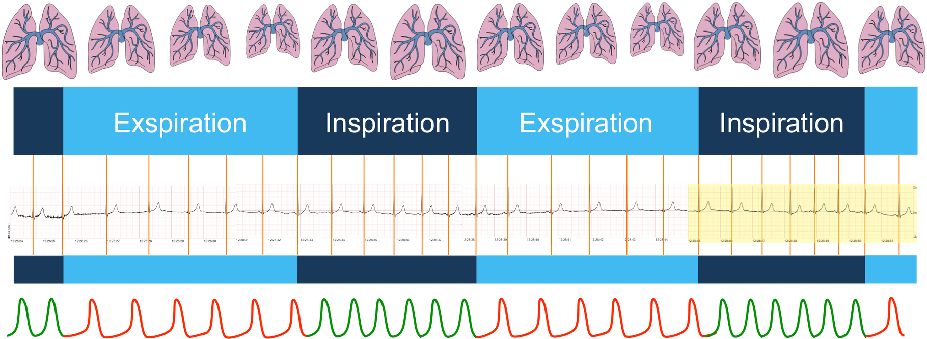 Respiratorische Sinusarrhythmie Herzkurven