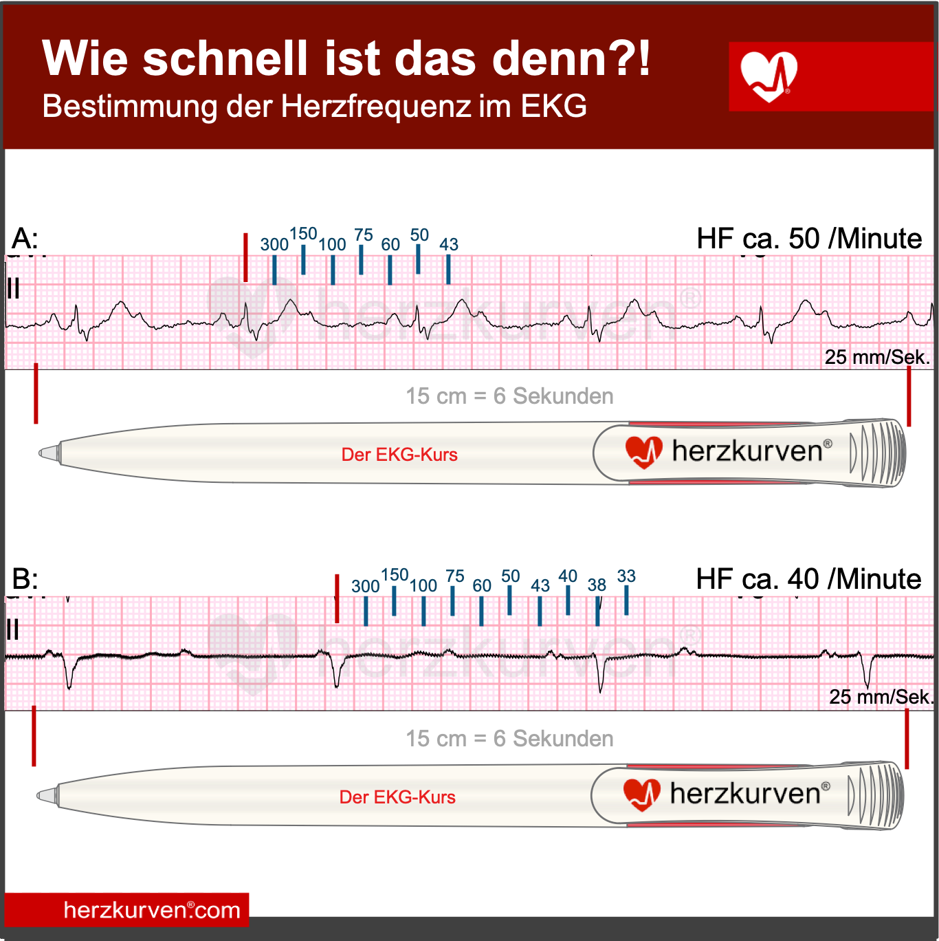 Der EKGKurs herzkurven