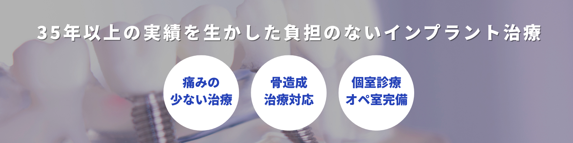 インプラント治療