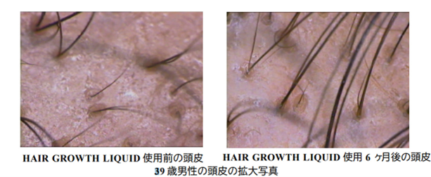 発毛と脱毛のバランスを整えるファルコレックスHGLの効果とは？ 