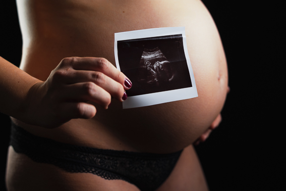 Nahaufnahme Babybauch, eine Hand hält ein Ultraschallbild vor den Bauch im Studio