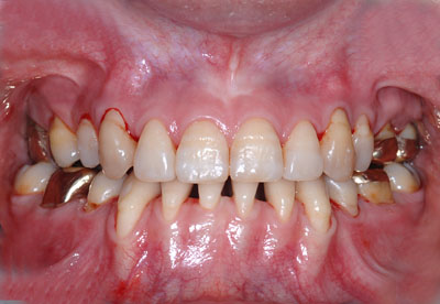 ジーナ浜松 18 裏側矯正失敗の顎関節症から復活 美しく生きるアメリカ歯科標準治療