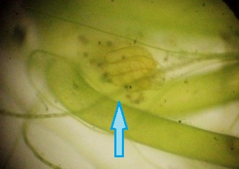 イノカシラフラスコモ　雌株の生卵器