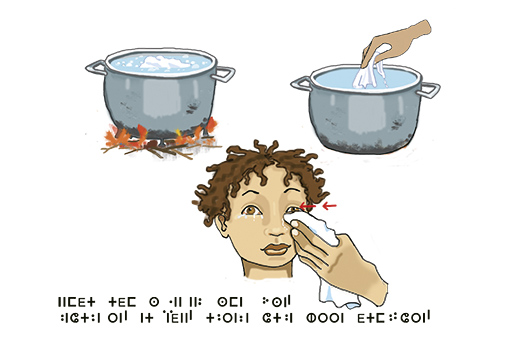illustration: hygiène des yeux