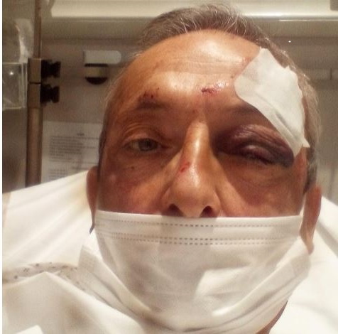 Monsieur René FORNEY Victime d'une tentative d'assassinat le Samedi 12 Novembre 2022 vers 15h50 sur le pont de CATANE côté SEYSSINET (38170). Il accuse les Milieux de la Corruption dans les Institutions du CARTEL GRENOBLOIS  (Justice, Police, Immobilier) 