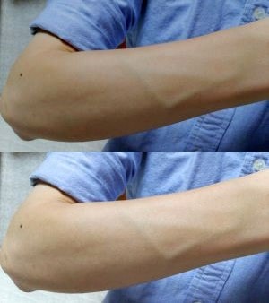 ケノンの効果写真などに必要範囲内の写真加工は行いました。