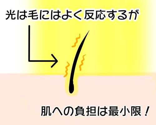 光脱毛は肌への負担を最小限に抑えている