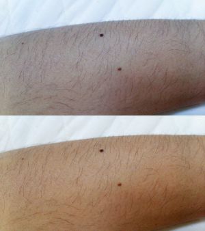 ケノンの効果写真などに必要範囲内の写真加工は行いました。