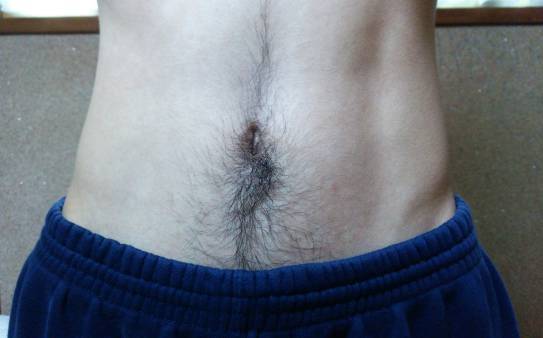 ケノンで濃い腹毛を薄くする前