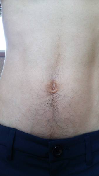 ケノンで濃い腹毛を薄くした