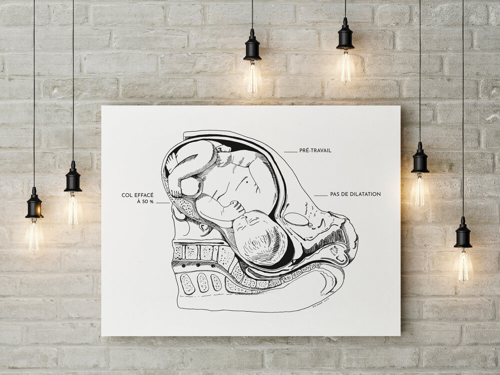 Planche "Anatomie de l’accouchement" : le pré-travail.