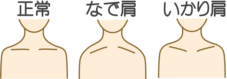 なで肩ってなおるの？