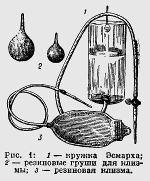 Очистительная клизма грушей. Кружка Эсмарха 19 века. Очистительная клизма Кружка Эсмарха. Кружка Эсмарха схема. Кружка Эсмарха стеклянная старинная.