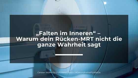 „Falten im Inneren“ – Warum dein Rücken-MRT nicht die ganze Wahrheit sagt