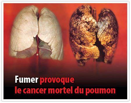 Pourquoi je ne veux pas cesser de fumer