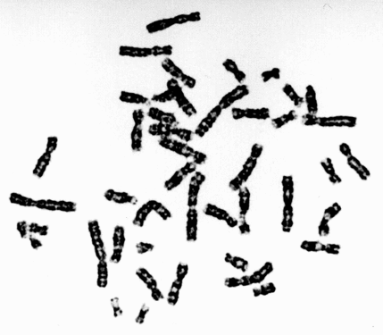 Chromosomes doubles obtenus après centrifugation d'une cellule. Ils ne sont pas classés, il ne s'agit donc pas d'un véritable caryotype.