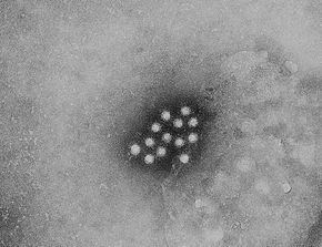 Virus de l'hépatite A transmissible par voie orale.
