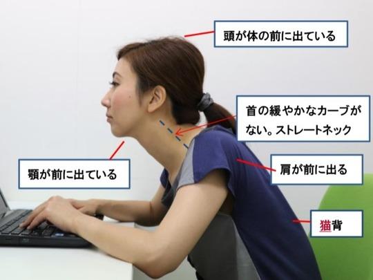 不良姿勢は本当に体に悪い？