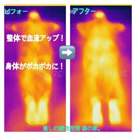 【血流アップで代謝アップ】整体ダイエットを受けるなら新潟市中央区の癒しの総合空間 森の家。へ