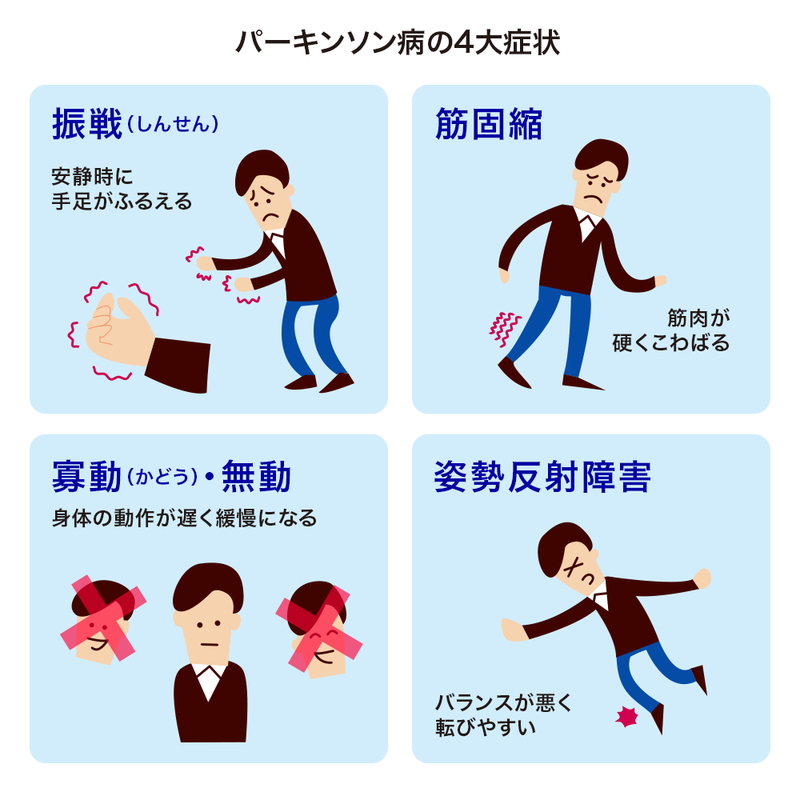 パーキンソン病の特徴