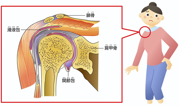 五十肩(肩関節周囲炎)
