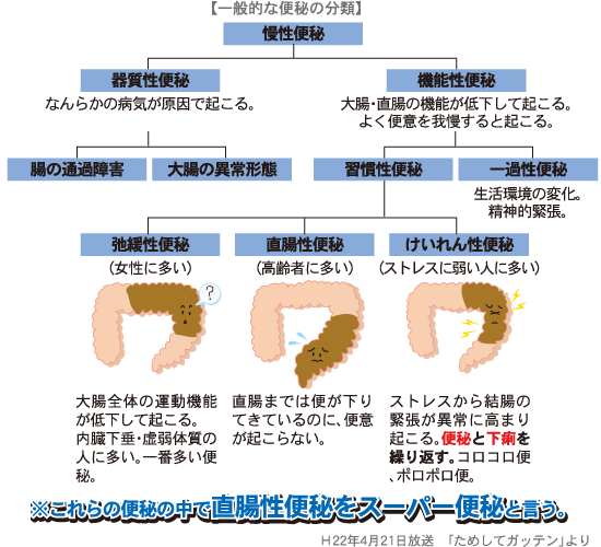 便秘の種類