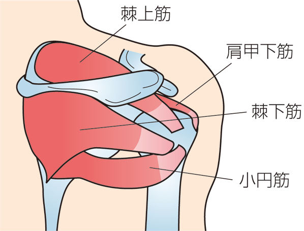 腱板損傷
