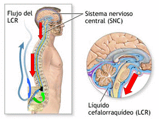 Como Manejar La Cefalea Post- Punción Dural En Obstetricia